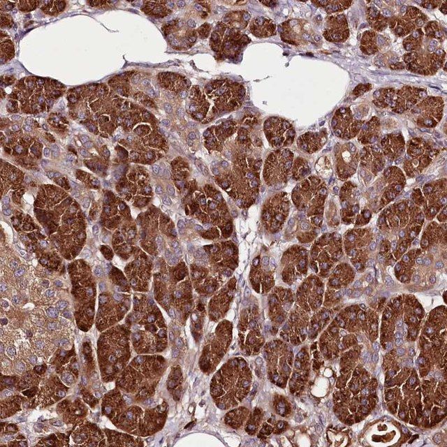 Anti-TARS antibody produced in rabbit