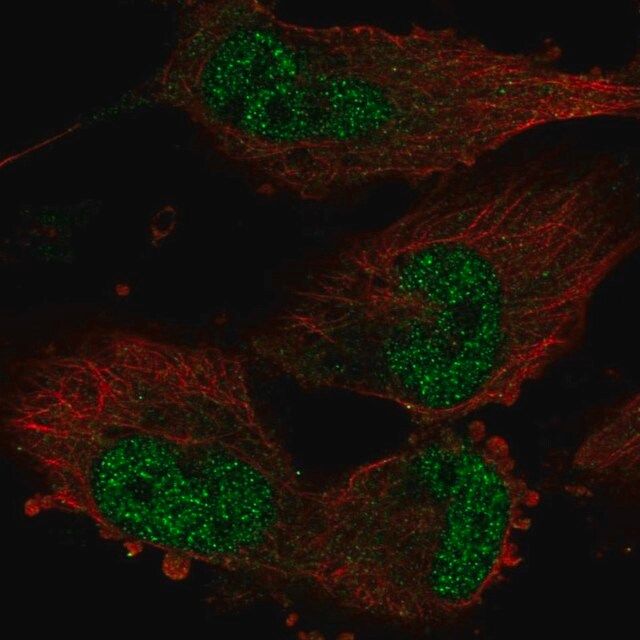 Anti-TATDN1 antibody produced in rabbit