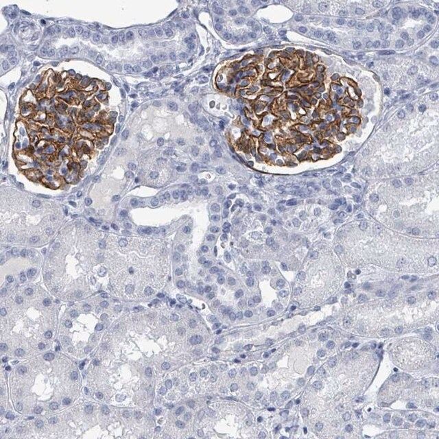 Anti-TAS2R1 antibody produced in rabbit