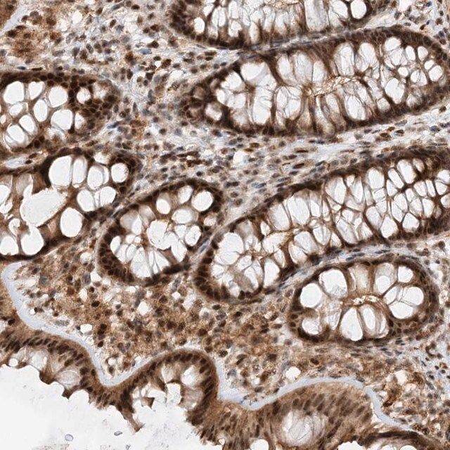 Anti-TATDN3 antibody produced in rabbit