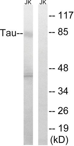 Anti-TAU antibody produced in rabbit