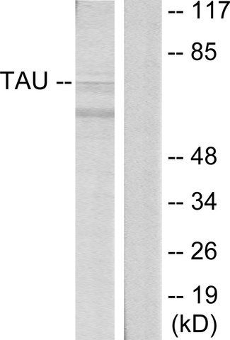 Anti-TAU antibody produced in rabbit