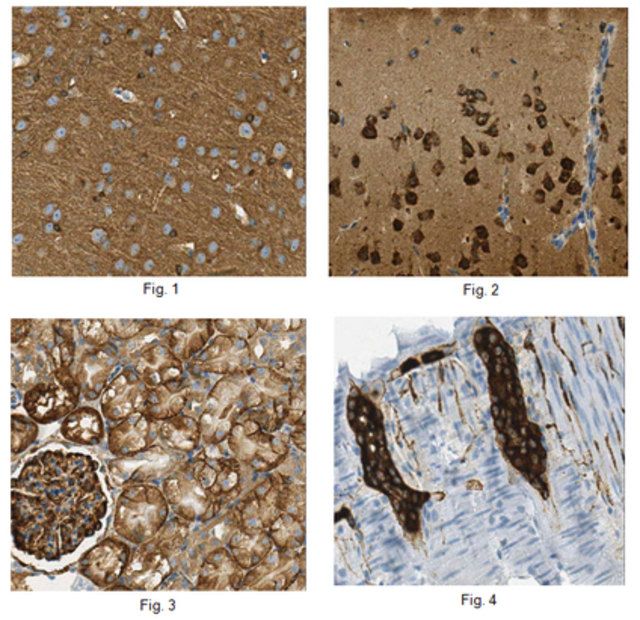 Anti-Tau Antibody, clone T49 (Not human)