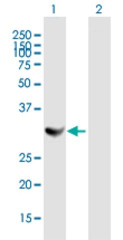 Anti-TBCB antibody produced in mouse