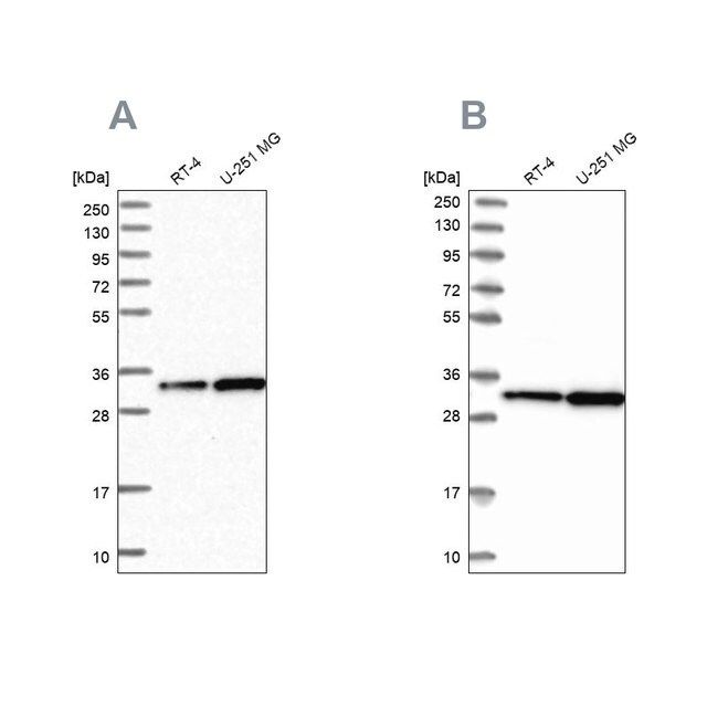 Anti-TBCB antibody produced in rabbit