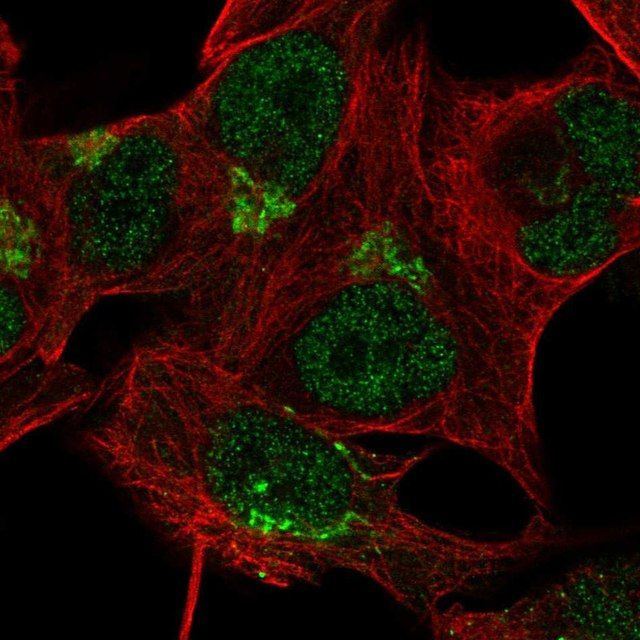 Anti-TBC1D14 antibody produced in rabbit