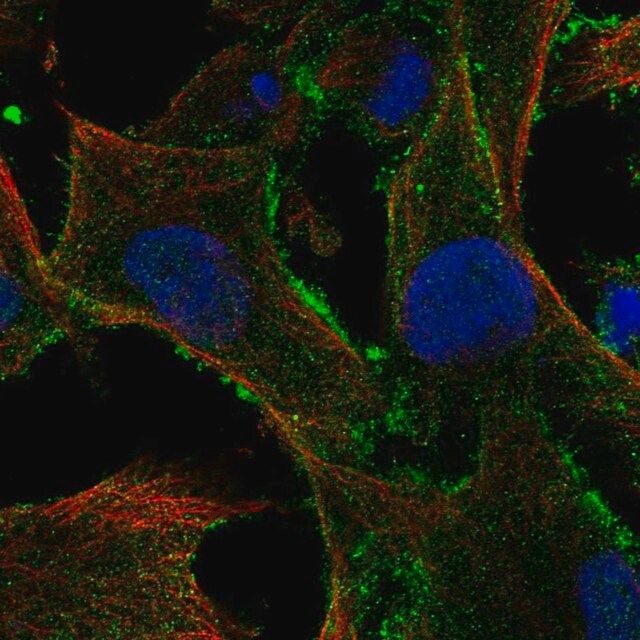 Anti-TBC1D10A antibody produced in rabbit