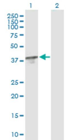 Anti-TBCC antibody produced in mouse