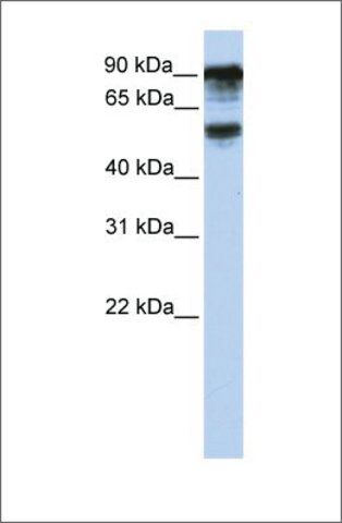 Anti-TBC1D10B antibody produced in rabbit