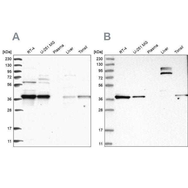 Anti-TBCC antibody produced in rabbit