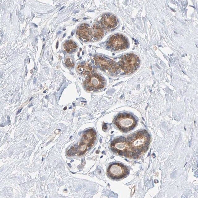 Anti-TATDN1 antibody produced in rabbit