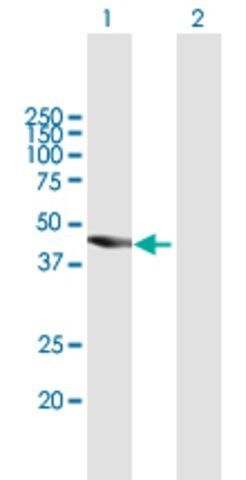 Anti-TBC1D16 antibody produced in mouse