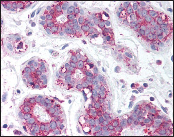 Anti-TBC1D1 antibody produced in rabbit