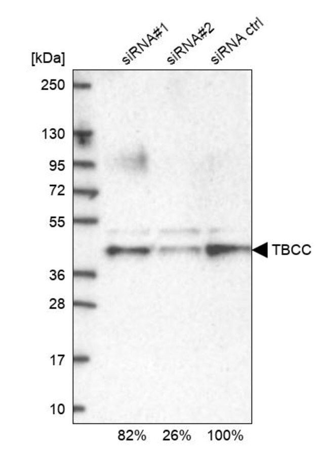 Anti-TBCC antibody produced in rabbit