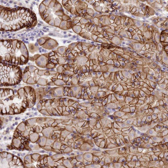 Anti-TBCD antibody produced in rabbit