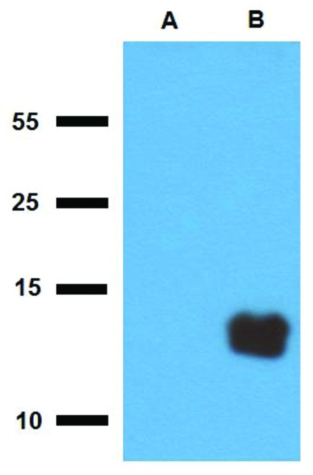 Anti-Tb10.3 (M. tuberculosis) antibody produced in rabbit