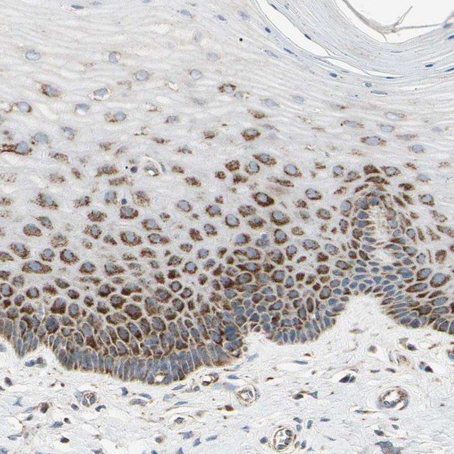 Anti-TBC1D10A antibody produced in rabbit