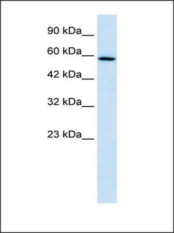 Anti-TBC1D10B antibody produced in rabbit