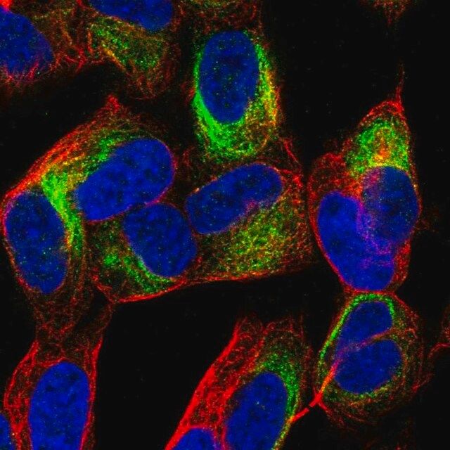 Anti-TBC1D16 antibody produced in rabbit