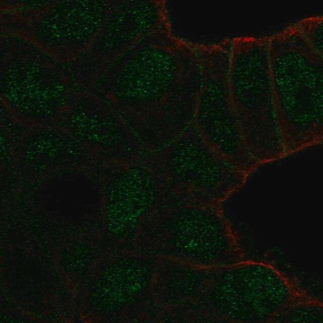 Anti-TBC1D10A antibody produced in rabbit