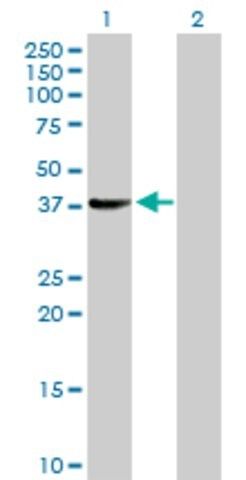 Anti-SUGT1 antibody produced in rabbit