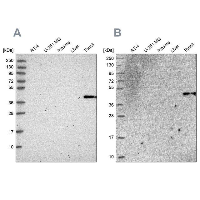 Anti-SULT2B1 antibody produced in rabbit