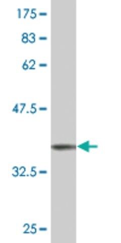 ANTI-STYK1 antibody produced in mouse