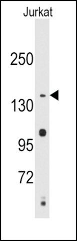 Anti-SULT1C2 (N-term) antibody produced in rabbit