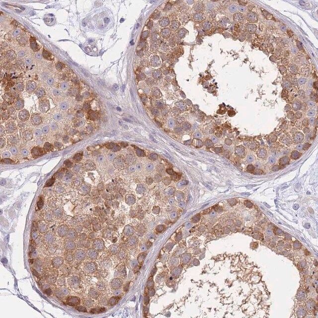 Anti-SUGT1 antibody produced in rabbit