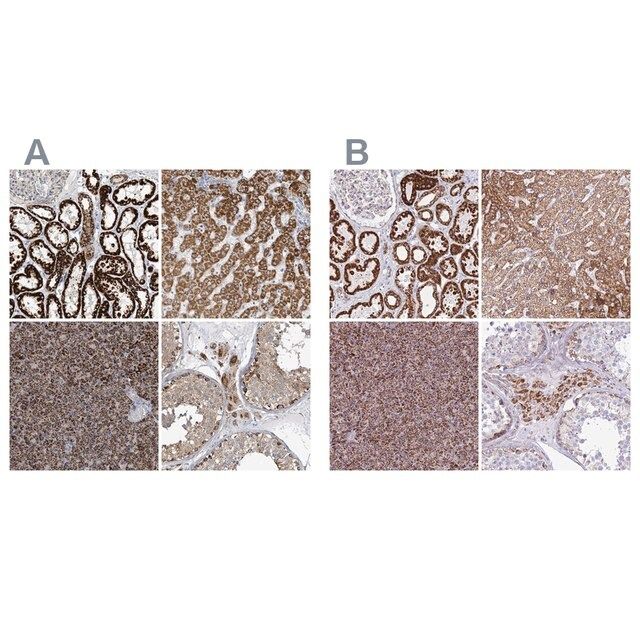 Anti-SUCLG2 antibody produced in rabbit