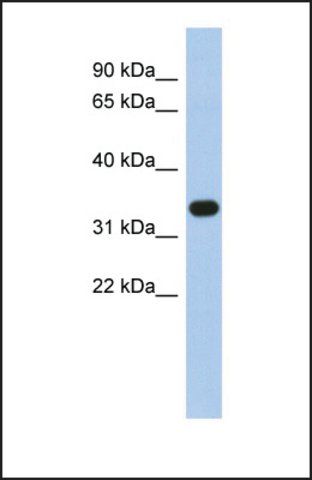 Anti-SULT1B1, (N-terminal) antibody produced in rabbit