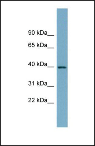 Anti-SULT2B1, (N-terminal) antibody produced in rabbit