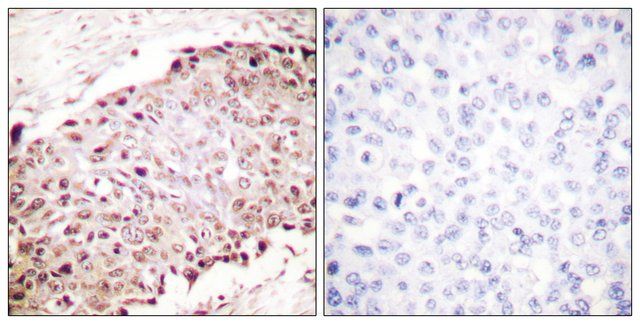 Anti-SUMO1, N-Terminal antibody produced in rabbit