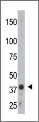 Anti-SULT2B1a/b (N-term) antibody produced in rabbit