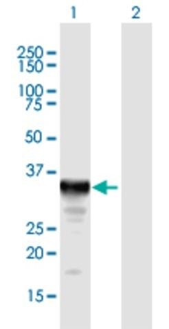 Anti-SULT1E1 antibody produced in mouse