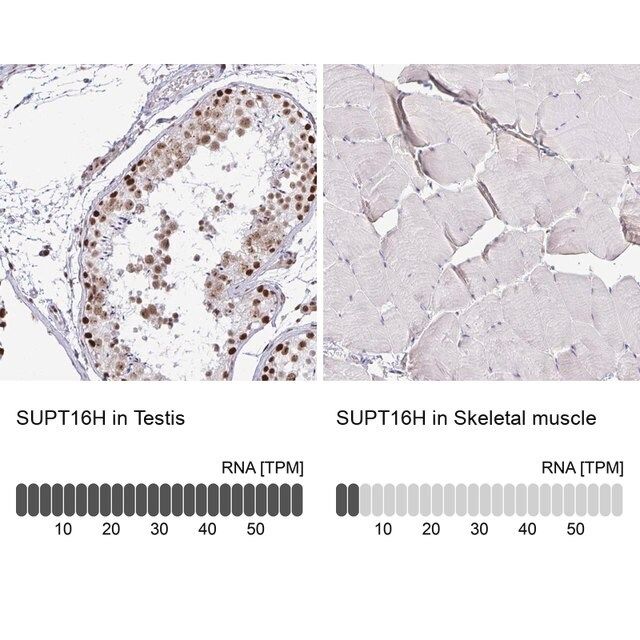 Anti-SUPT16H antibody produced in rabbit