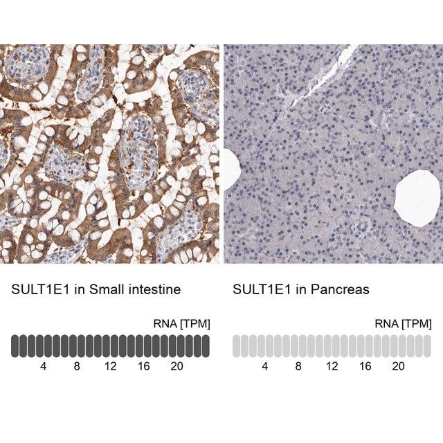 Anti-SULT1E1 antibody produced in rabbit