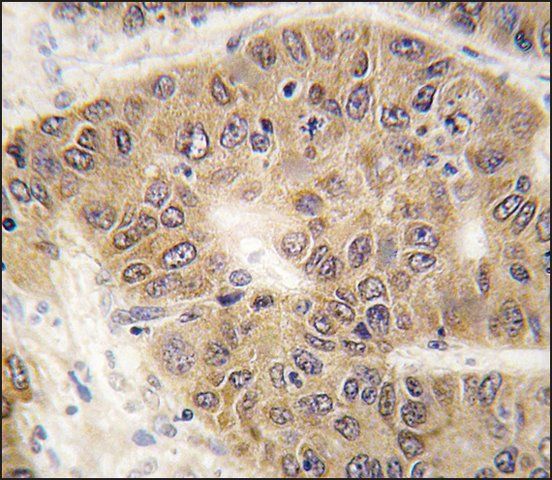 Anti-SUMO4 (V55 Mutant) antibody produced in rabbit