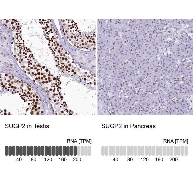 Anti-SUGP2 antibody produced in rabbit