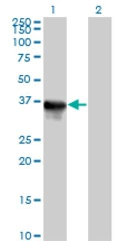 Anti-SULT1E1 antibody produced in mouse