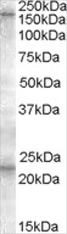 Anti-SUR1/ABCC8 antibody produced in goat