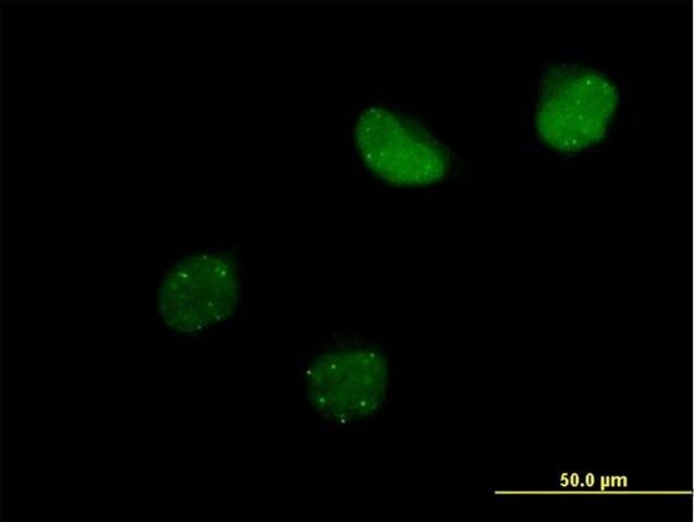 Anti-SUMO4 antibody produced in mouse