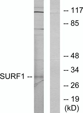 Anti-SURF1 antibody produced in rabbit