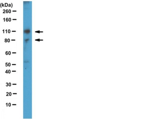 Anti-SUN1 Antibody