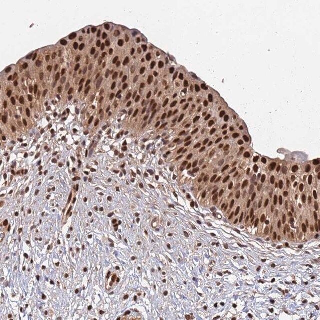 Anti-SUMO2 antibody produced in rabbit