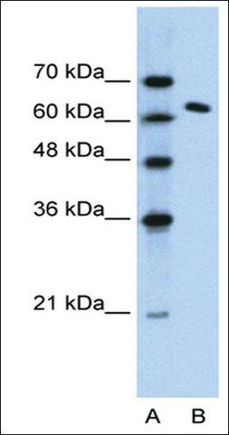 Anti-SUPT16H antibody produced in rabbit