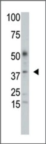 Anti-SULT2B1a/b (C-term) antibody produced in rabbit