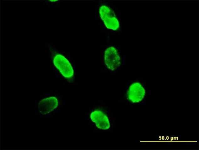 Anti-SUMO3 antibody produced in mouse