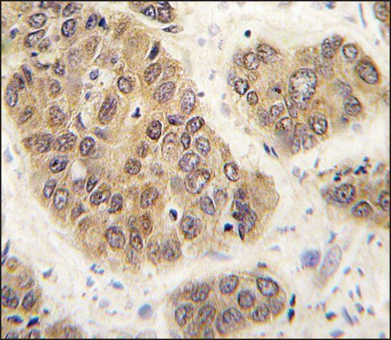 Anti-SUMO4 (M55 Wild type) antibody produced in rabbit