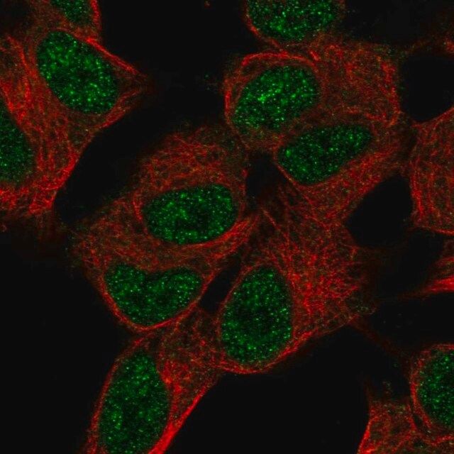 Anti-SUPT7L antibody produced in rabbit